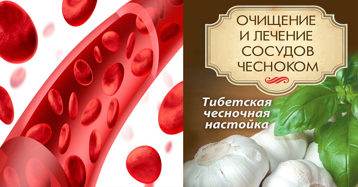 Чистка сосудов чесноком. Очищение сосудов чесноком. Тибетское средство для очистки сосудов чеснок. Тибетский метод очистки сосудов. Тибетская чистка сосудов чесноком.