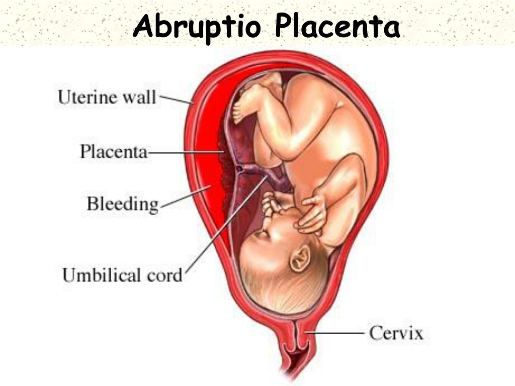 22 неделе плацента